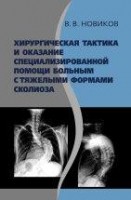 Хирургическая тактика и оказание специализированной помощи больным с тяжёлыми формами сколиоза