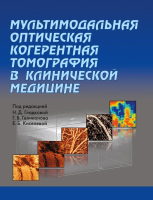 Мультимодальная оптическая когерентная томография в клинической медицине
